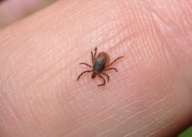 pediculosis o piojos