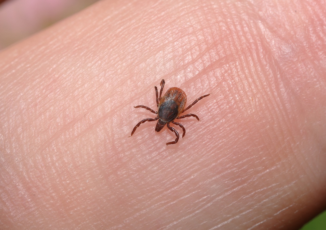 pediculosis o piojos