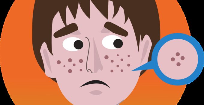 ¿Son peligrosos los ácaros?