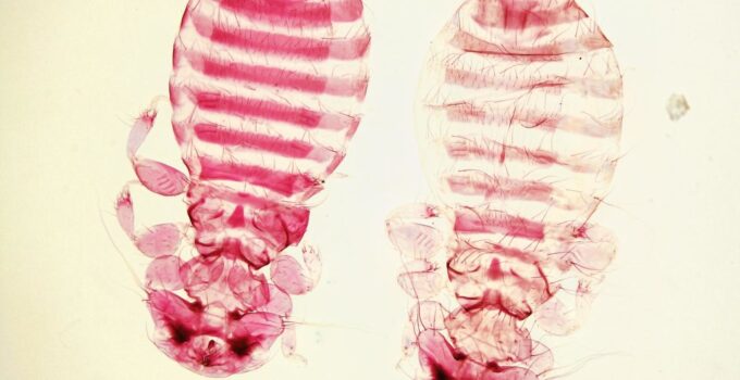 De dónde vienen los piojos