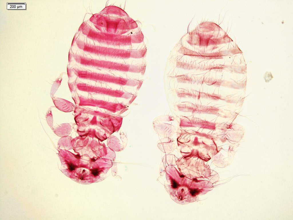 De dónde vienen los piojos