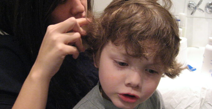 ¿Cómo se pueden detectar los piojos?